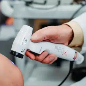 Laser Therapy plantar fasciitis and chronic foot pain