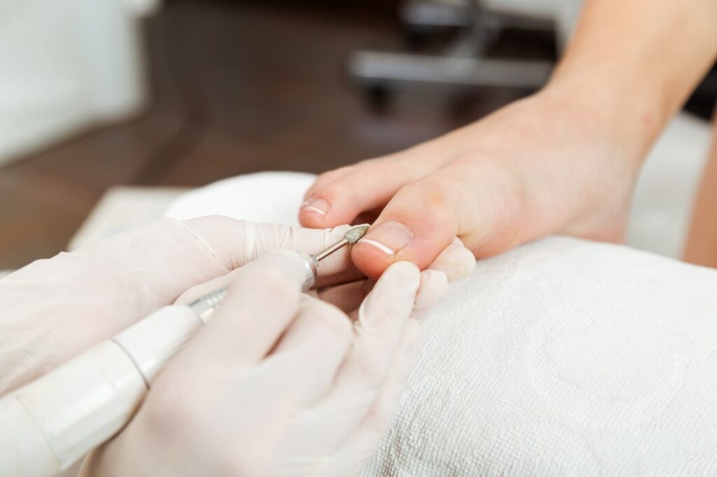 Foot Care Services - LMC Footcare